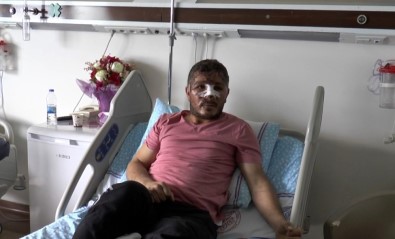 Motosiklet Kaskı Kırık Diye Takmayan Sürücü Dehşeti Yaşadı