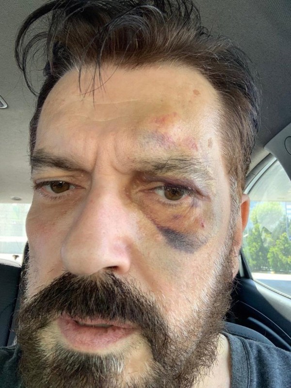 Hakan Bayrakçı’ya saldırı