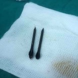 KÜÇÜK ÇOCUK - Esad Rejimi, Çivi Bombaları Kullanmaya Devam Ediyor