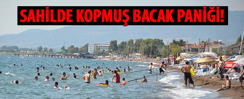 Sahilde kopmuş bacak paniği!