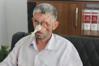 MUSTAFA KEMAL ÜNIVERSITESI - Dişini Çektirdi, Gözünü Kaybetti