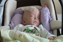 ERKEN DOĞUM - Prematüre Bebeğe Beyin Ameliyatı