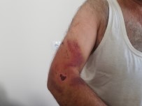 İHLAS - Engelli Kız Ve Babasına 'Bana Niye Oy Vermedin' Dayağı