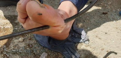 Ayağına Yaba Saplandı