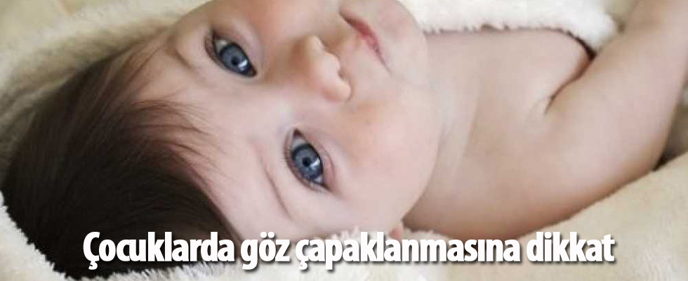 Çocuklarda göz çapaklanmasına dikkat