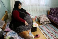 GÜNEŞLER - Sakarya'da Yaşayan Ve 250 Kilo Olan Sevim Bal Obezite Ameliyatı İle 95 Kiloya Düştü