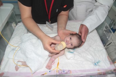 Doğduktan 24 Saat Sonra Yapılan 'Yemek Borusu' İle Hayata Tutundu