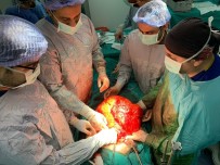BÜLENT ECEVİT ÜNİVERSİTESİ - Karın Şişliğiyle Hastaneye Başvurdu, 11 Kiloluk Kitle Çıktı