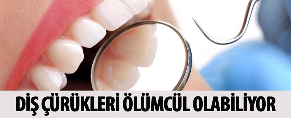 Diş çürükleri ölümcül olabiliyor