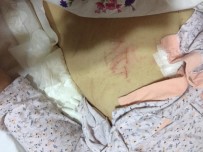 HASTA HAKLARI - Denizli'de Yatalak ALS Hastasının Karnına Tırnakla 'ATT' Yazıldı İddiası