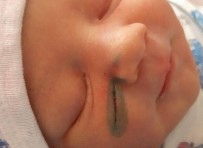 DOĞUM SANCISI - Rusya'da doktorlar doğum sırasında bebeğin yüzünü kesti