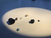 Kulak Burun Boğaz Uzmanı Ali Fuat Şaşoğlu Açıklaması 'Hastanın Burnundan 15 Yıl Sonra Tespih Boncuklarını Çıkarttık'