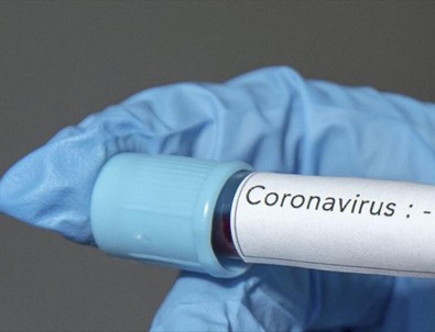 Uzmanlardan coronavirüs uyarısı! Coronavirüste yeni belirti olabilir