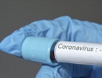 Uzmanlardan coronavirüs uyarısı! Coronavirüste yeni belirti olabilir