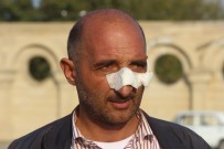 Berde'deki Roketli Saldırıda Yüzünden Yaralanan Ağalarov Korku Dolu Anları Anlattı