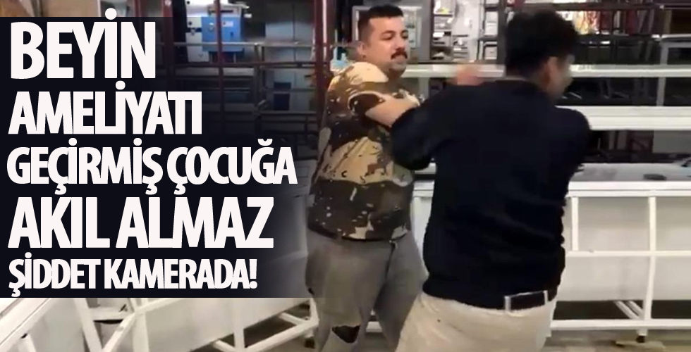 Beyin ameliyatı geçirmiş çocuğa akıl almaz şiddet kamerada