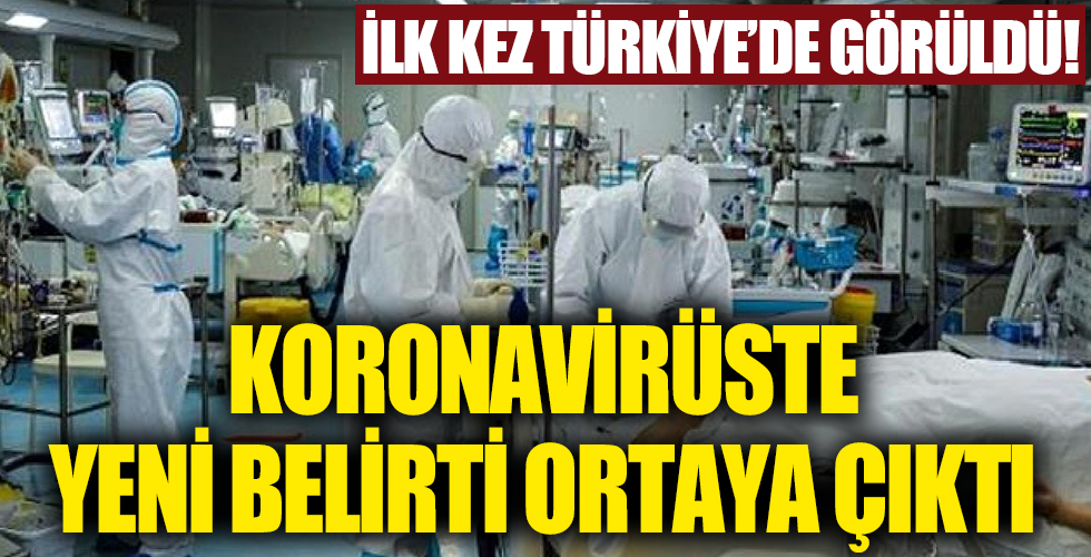 Koronavirüsün bir belirtisi daha ortaya çıktı! Dünyada ilk kez Türkiye’de görüldü!