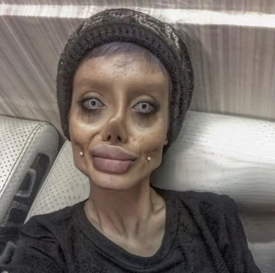 Başından beri her şey yalan çıktı! İşte İranlı 'Zombi Gelin'in son hali...