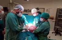 YUNUS EMRE - 18 yaşındaki kızın karnından çıkarıldı. Tam 9 kilo...