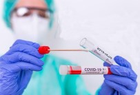 Pakistan'da Korona Salgınında Son 24 Saatte Rekor Sayıda Can Kaybı