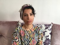 Burun Estetiği Kabusu Oldu