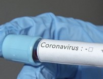 YAKIN TAKİP - Çorum Valiliğinden 'koronavirüs' açıklaması