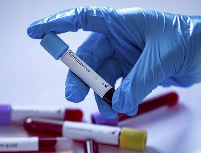 Türk bilim insanından flaş corona virüs aşısı hamlesi