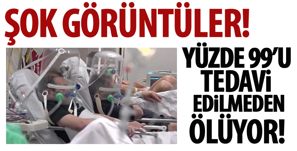 Çarpıcı araştırma sonuçları! Koronavirüs koğuşundan dünyayı tedirgin eden görüntüler