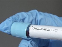 Çin’de yapılan çalışmadan korkutan sonuç: Koronavirüsün yeni belirtileri ortaya çıktı