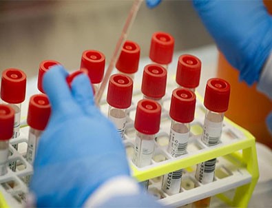 Bilim Kurulu üyesi Prof. Ateş Kara Çin'den gelen kitlerle ilgili korkunç gerçeği açıkladı