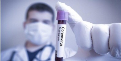 Çinli doktor uyardı! Koronadan korunmak için bunları yemeyin