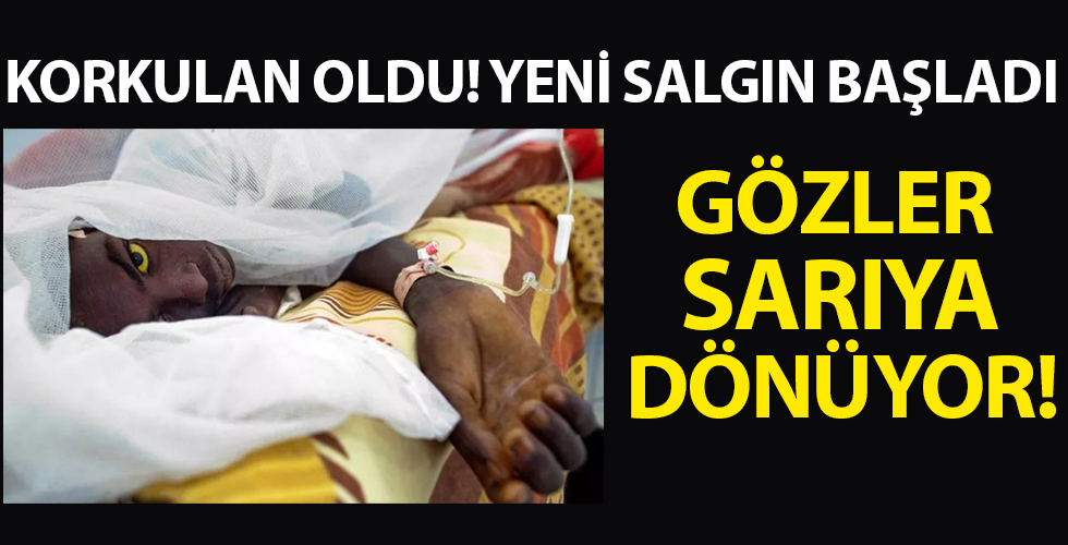 Yeni bir salgın başladı! Gözler sarıya dönüyor...