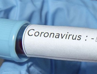 İtalya'da son 24 saatte 525 kişi daha öldü!