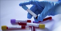 NOBEL TIP ÖDÜLÜ - Madagaskar'dan koronavirüs ilacı iddiası