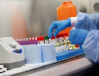 AMERIKA BIRLEŞIK DEVLETLERI - Koronavirüs'te ezber bozan sigara araştırması!