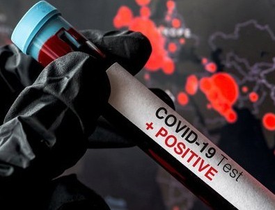Koronavirüsten ölüm riskini 3 kat artırıyor!