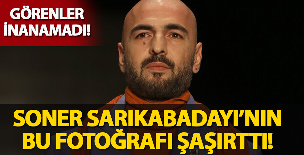 Soner Sarıkabadayı�nın bu hali görenleri şok etti!
