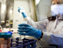 HASTANE - Türk bilim insanları geliştirdi: Koronavirüsü 15 saniyede öldürüyor