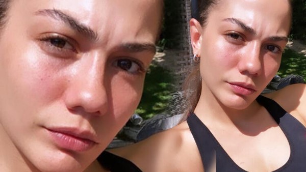 Demet Özdemir bu fotoğrafıyla şaşırttı!
