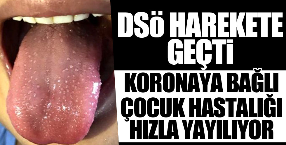 Çocuk hastalığı için DSÖ harekete geçti