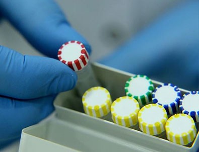 Tanı kitlerinde koronavirüs tespit edildi!