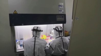 Azerbaycan'da 57 Kişide Daha Korona Virüs Tespit Edildi