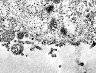 Corona virüsün hücreye saldırı anı bilim insanlarınca görüntülendi