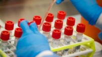 SAĞLIK UYGULAMA TEBLİĞİ - Tanı konmayan hastaya corona virüs testi de ücretsiz
