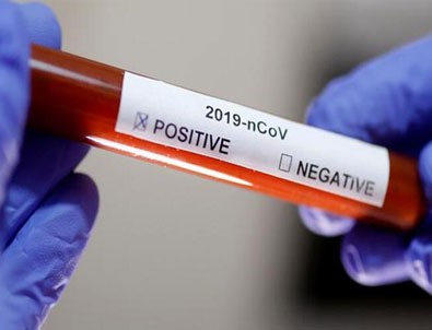 3 üniversite çalışmalara başladı!