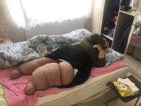 Yakalandığı Fil Hastalığı Onu  Eve Mahkum Etti