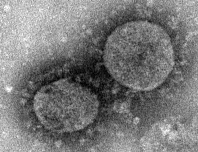 ABD yeni bir salgın başladı!