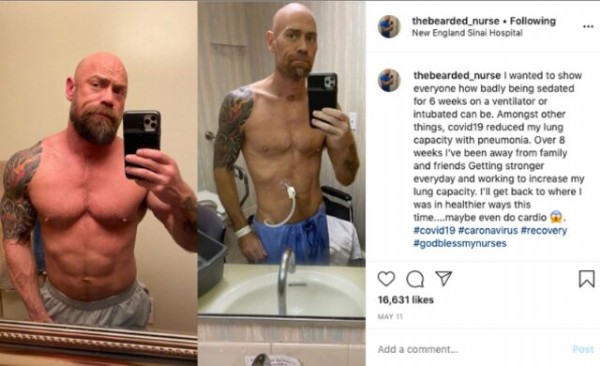 Covid-19 nedeniyle 6 hafta hastanede kalan adam tanınmayacak hale geldi