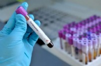 OXFORD - İlaç şirketinden flaş koronavirüs açıklaması! Tarih verdiler