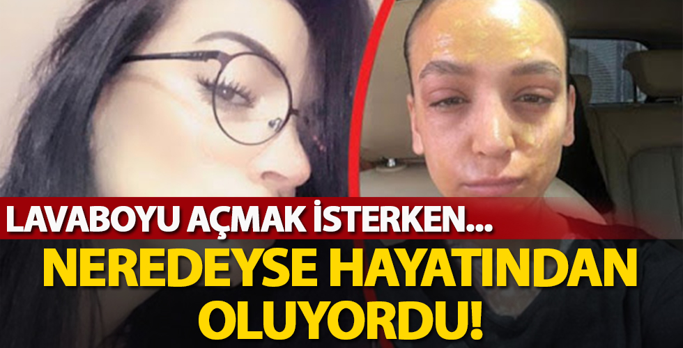 Yüzüne öyle bir şey patladı ki...Talihsiz kadın feci şekilde yandı!